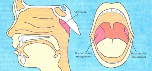 Поза льва упражнение для очищения миндалин. «Поза льва» — упражнение для очищения миндалин