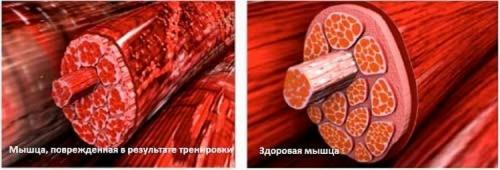 Как снять мышечную боль после тренировки в икрах ног. Топ 6 причин боли в икроножных мышцах и что делать?