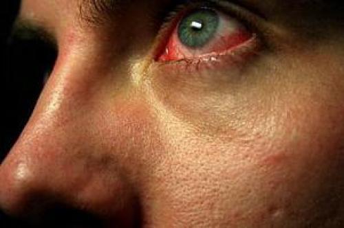 Как избавиться от паники. Способы лечения 04