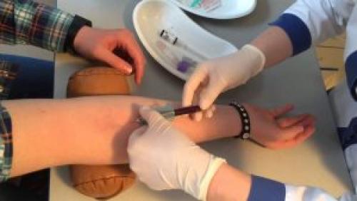 Почему повышается холестерин. Высокий холестерин