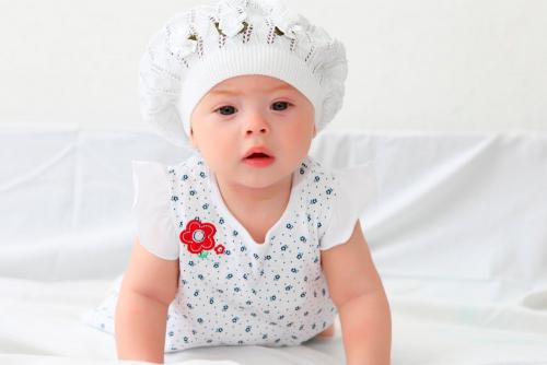 Солнечные люди синдром. Синдром или болезнь?