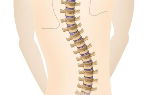 Васиштхасана при сколиозе. Йога при сколиозе: что это и для чего