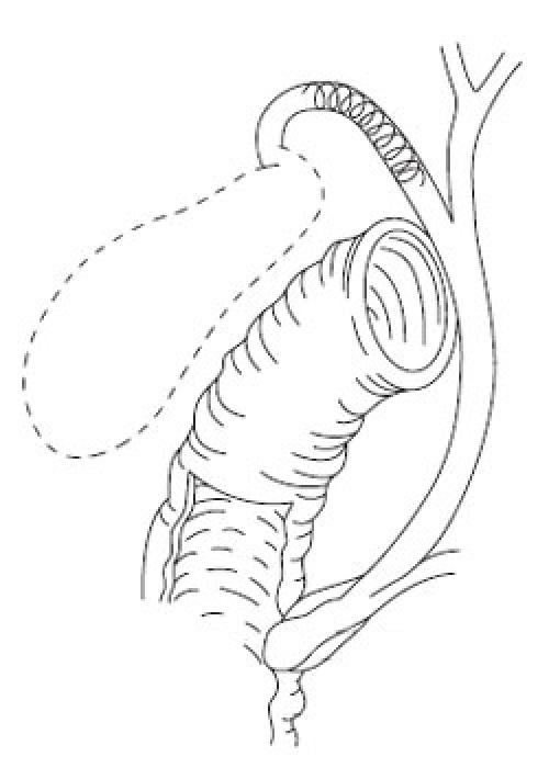 Как себя вести после измены мужа советы психолога. Причины, толкающие мужей к измене 01