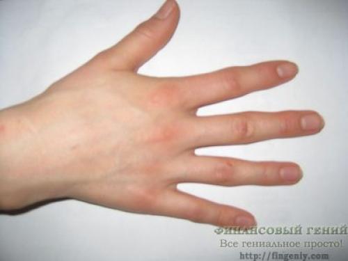 МЕТОД пяти пальцев. Метод 5 пальцев