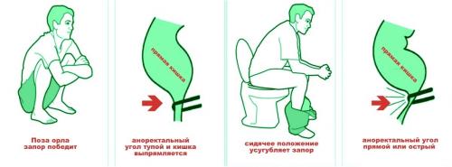 Поза орла при дефекации. Как происходит опорожнение кишечника в норме