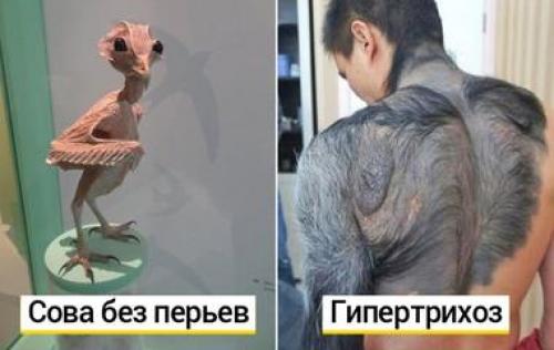 Самые интересные психические расстройства. Редчайшие синдромы и психические расстройства, о которых вы не слышали