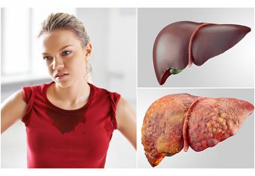 Как убрать жир вокруг печени. Методы очищения печени от жира: обзор эффективных медикаментов