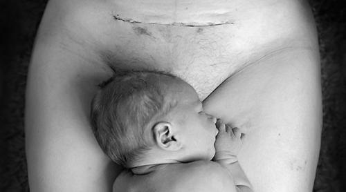 Как перебороть страх перед операцией. как победить страх перед операцией!) 05