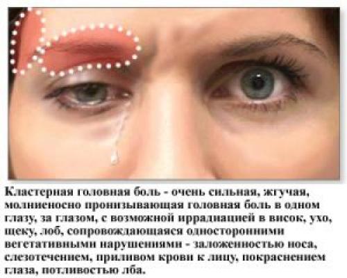 Боли при всд. Виды и симптомы болей при вегетососудистой дистонии