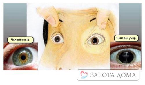 Суженный зрачок не реагирует на свет. Как выглядят зрачки при смерти