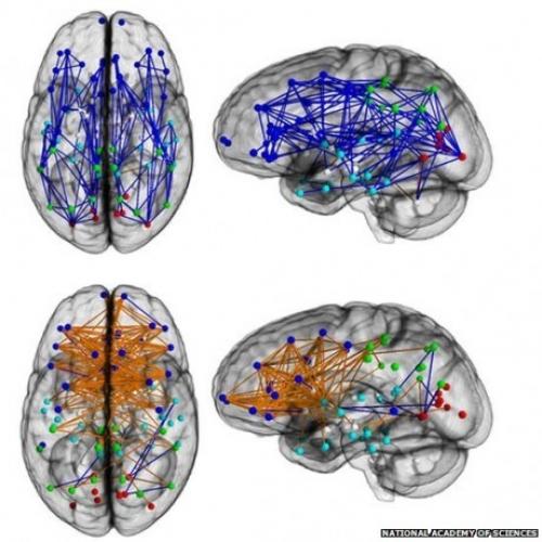 Как устроен женский мозг. Мужской и женский мозг устроены по-разному
