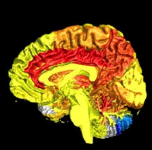 Чем мозг мужчины отличается от мозга женщины. 20 невероятных отличий женского и мужского мозга Чем мозг мужчины отличается от мозга женщины. 20 невероятных отличий женского и мужского мозга