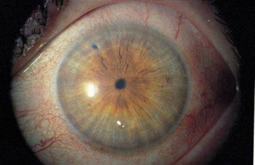 Сужение и расширение зрачка. ЯЗЫК ТЕЛА: О ЧЁМ ГОВОРИТ, СУЖЕНИЕ И РАСШИРЕНИЕ ЗРАЧКА 06