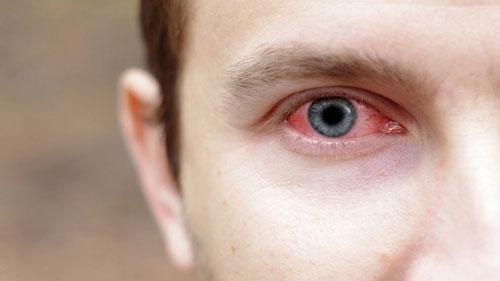 Как распознать наркомана. Как определить наркомана? Внешность и поведение