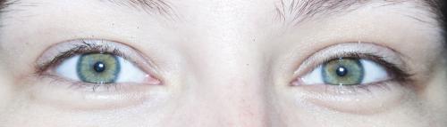 Как определить наркомана по глазам. Как по глазам определить, какой наркотик употребляет ваш близкий