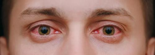 Как определить наркомана по глазам. Как по глазам определить, какой наркотик употребляет ваш близкий