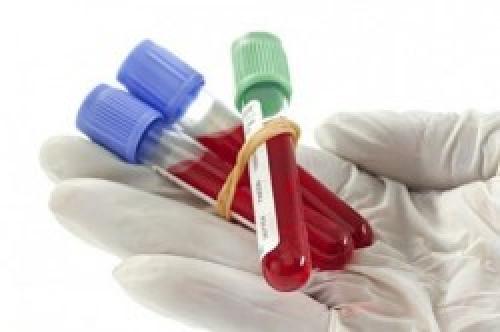 Чистка лимфы солодкой побочные эффекты. Что даст такая чистка — 9 фактов