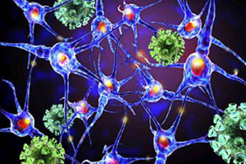 Периферический паралич Гийена-Барре