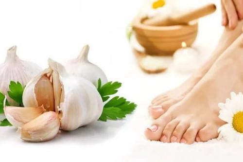 Чеснок от грибка. Как использовать чеснок от грибка ногтей