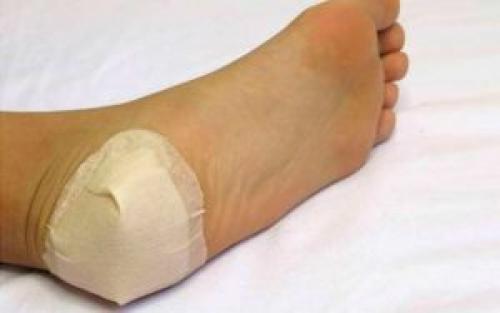 Чеснок от грибка. Как использовать чеснок от грибка ногтей