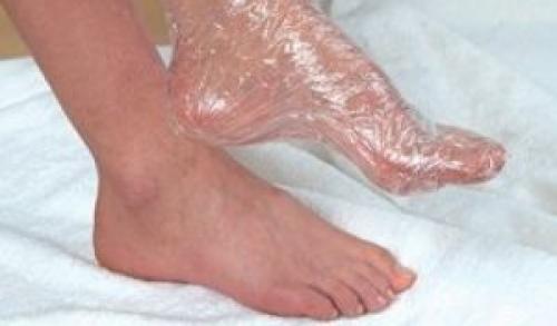 Чеснок от грибка. Как использовать чеснок от грибка ногтей