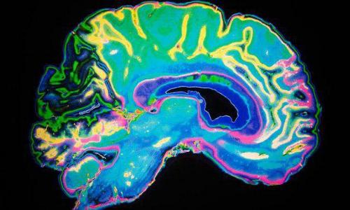 Почему Мне все лень хочется только лежать. Заболевание «апатия» - что делать, если ничего не хочется: причины