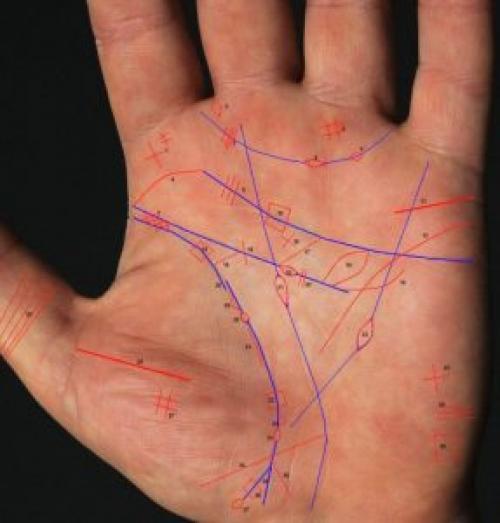 Болезни по руке. Посмотрите на свою руку внимательно