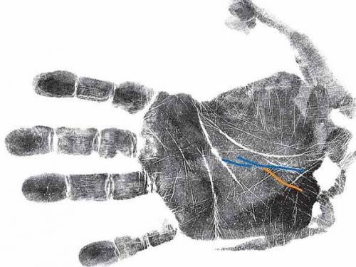 Болезни по руке хиромантия. Как узнать о болезнях по руке: секреты хиромантии
