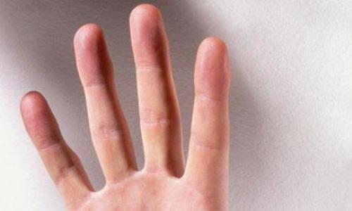 Вокруг пальца обвел. «Обвести вокруг пальца» - фразеологизм. Значение и примеры