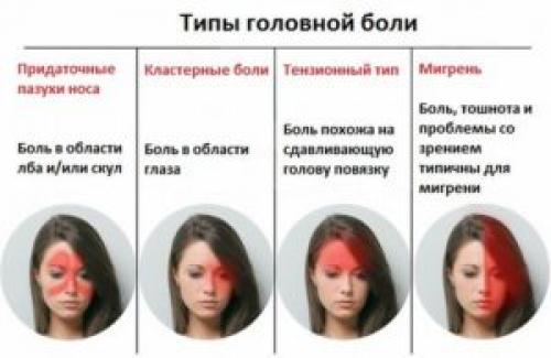 Цефалгический синдром, что это такое. Цефалгический синдром и вегетососудистая дистония: симптомы, лечение