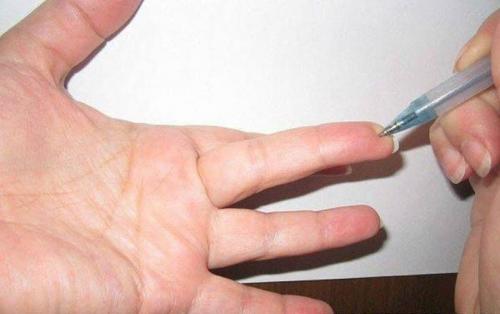 Точки ЭНЕРГИИ на теле человека. Волшебные точки на теле человека.