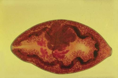 Как человек может заразиться печёночным сосальщиком опишите механизм. В острой стадии