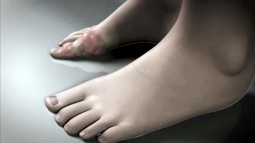 Как общество влияет на восприятие неизлечимых болезней. Неизлечимые болезни, с которыми можно жить долго и счастливо