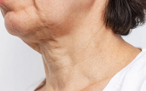 Улучшение внешнего вида после отказа от курения. Влияние табачного дыма на кожу