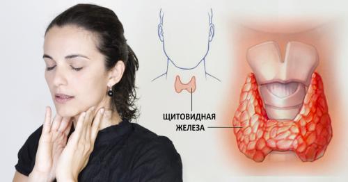 Заболевания щитовидной железы симптомы. Заболевания щитовидной железы: симптомы и лечение