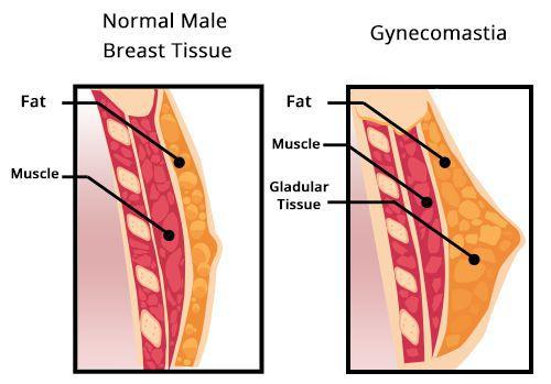 Признаки низкого тестостерона у мужчин. Симптомы нехватки тестостерона у мужчин 05