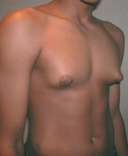 Признаки низкого тестостерона у мужчин. Симптомы нехватки тестостерона у мужчин 06