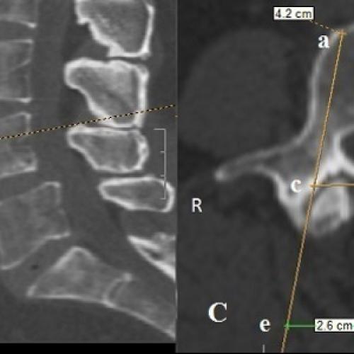 Может ли сердце остановиться от такого. Может ли сердце резко остановиться в моем случае? 05