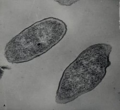 Боязнь микробов и грязи фобия. Мизофобия: страх загрязнений и микробов. Симптомы, причины и способы лечения. 04