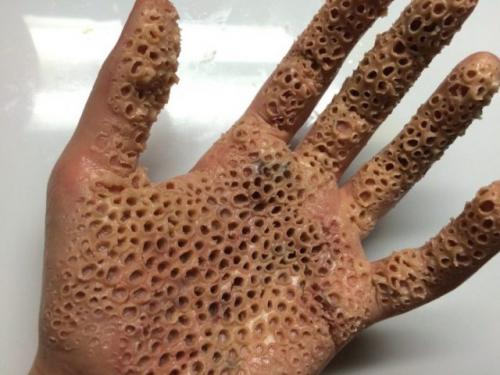 Лечение страхов фобий. Как лечат страх и где искать помощь? 03 Лечение страхов фобий. Как лечат страх и где искать помощь? 03