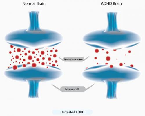 Как воспитывать гиперактивного ребенка. Гиперактивный или просто активный ребёнок? 02