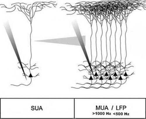 Какие методы исследования позволяют изучать топографию и характеристики внутреннего строения мозга. Методы исследования головного мозга