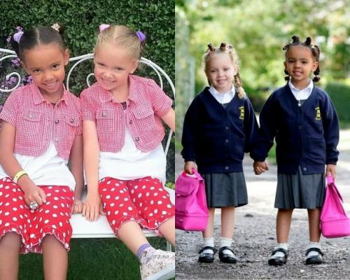 Марсия и милли биггс - этих девочек по праву можно назвать уникальными, ведь таких людей как они - один на миллион. 03