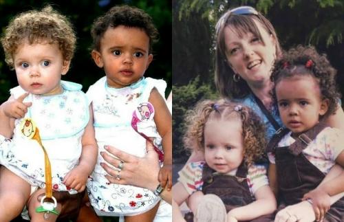 Марсия и милли биггс - этих девочек по праву можно назвать уникальными, ведь таких людей как они - один на миллион. 02