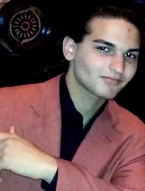 Этот американец стал первым в истории, кому смогли пересадить лицо и обе руки. 01