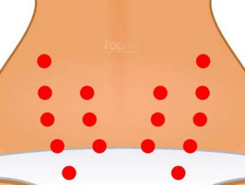 Как за 5 минут избавиться от головной боли. Как избавиться от головной боли за 5 минут без, каких-либо таблеток.