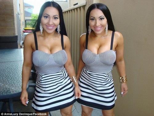 Анна и Люси десинк - близняшки, потратившие на пластику 250 тысяч долларов. 01