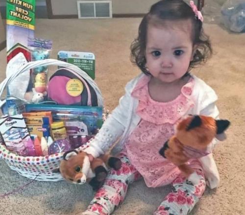 У этой малышки редкая генетическая мутация - синдром аксенфельда - ригера. 01