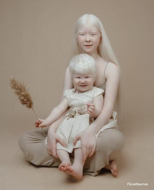 Альбиносы - люди, которые одарены уникальной красотой.