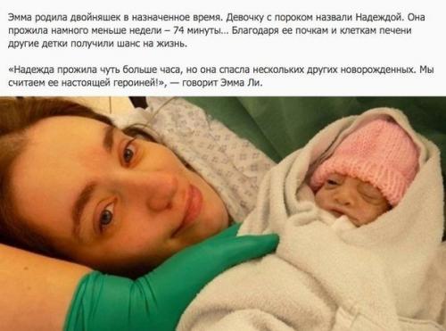 Невероятная история.  Женщина родила двойняшек, заранее зная что одна из низ погибнет при рождении из-за болезни! 04